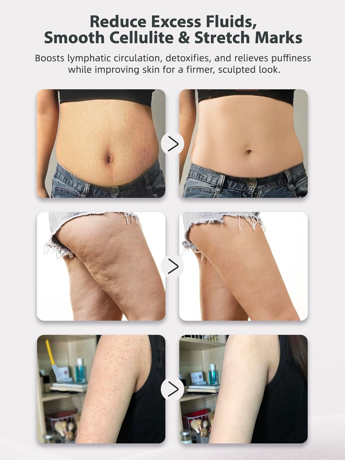 Lymphatic Drainage Massager & Anti Cellulite Massage Tool, Lymphatic Massager,Helps Reduce Stretch Marks & Cellulite，for Belly, Arms & Legs,Body Sculpting Machine with Heat & Vibration