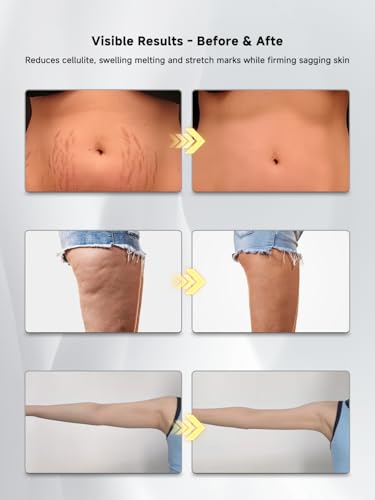 Lymphatic Massager for Body Contouring & Care – Handheld Device for Legs, Arms & Belly with Heat and Vibration, Aims to Improve Appearance of Skin Texture