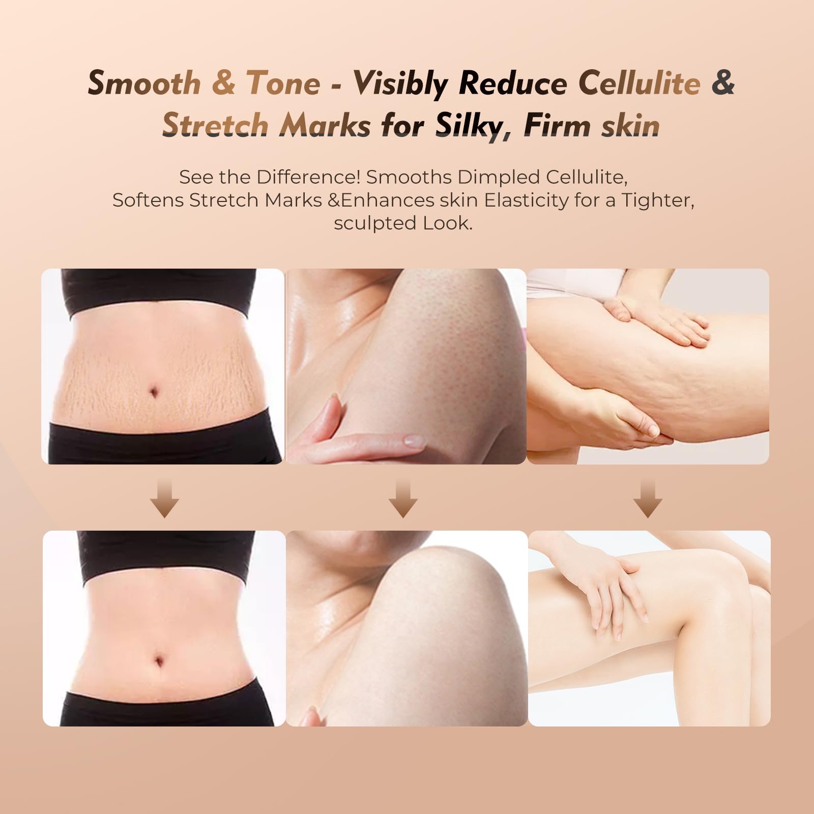 35-Speed 3-in-1 Lymphatic Drainage Massager - Cellulite Massage Tool for Legs, Arms, Belly | Anti Cellulite Massage Tool w/ Microcurrent, Heat, Vibration | Body Sculpting & Skin Renewal